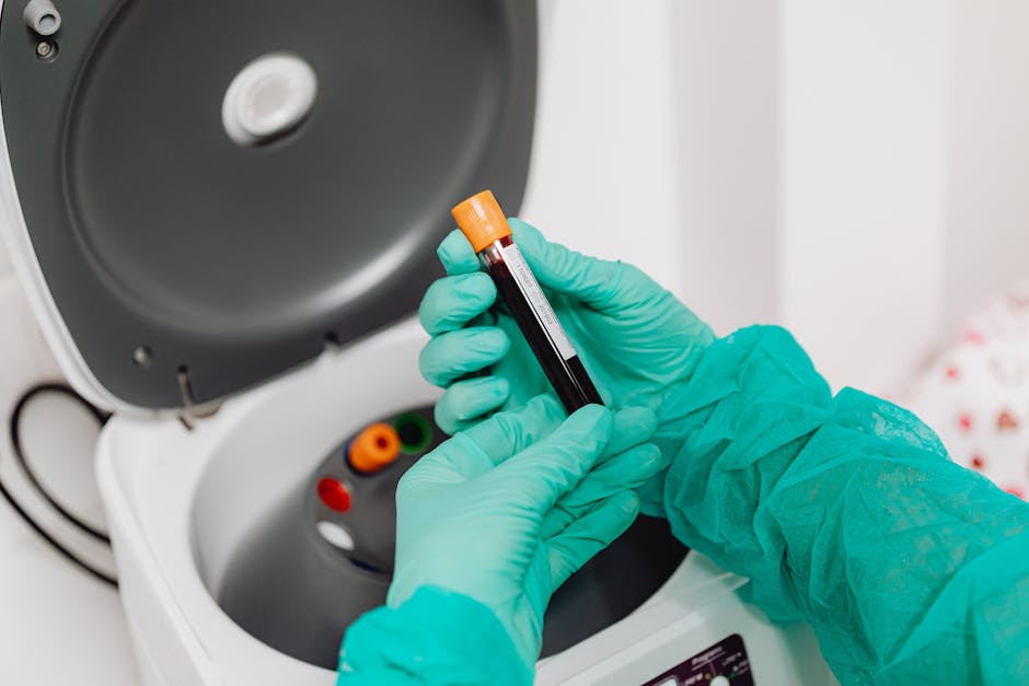 Platelet-rich fibrin