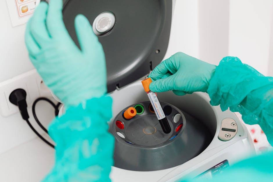 What is a platelet donation